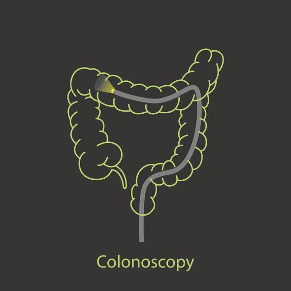 Super Funny Colonoscopy Puns to Enjoy 