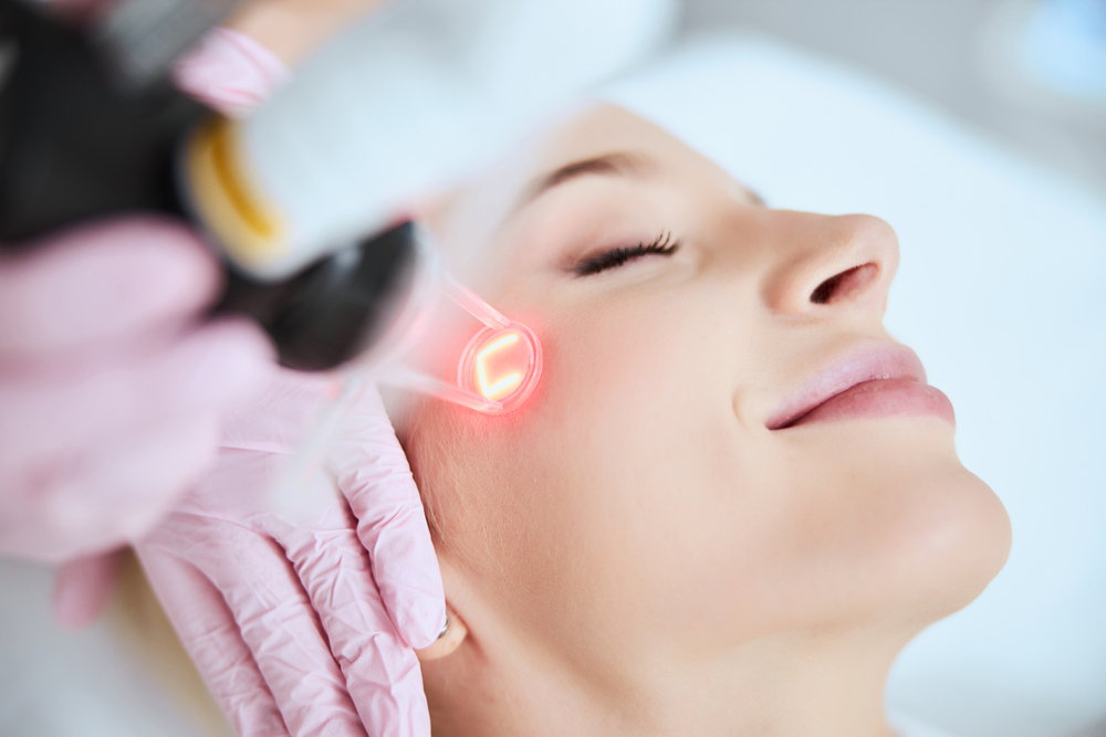 Laser Skin Resurfacing