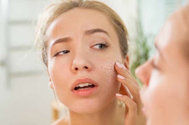 Skin Care Essentials: Remedies for Skin Tags and Dry Skin