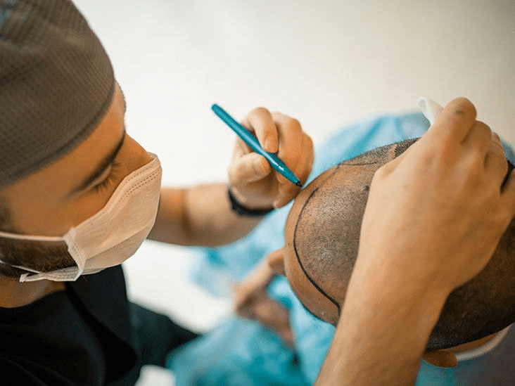 Hair Transplant budget
